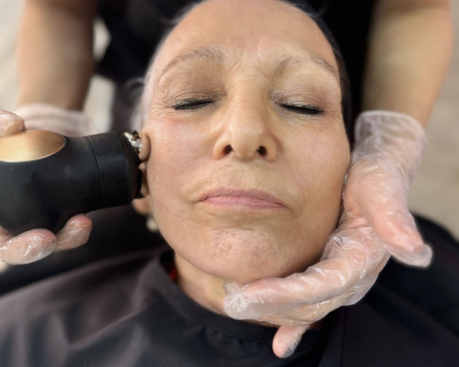 face-fit-entrenamiento-facial