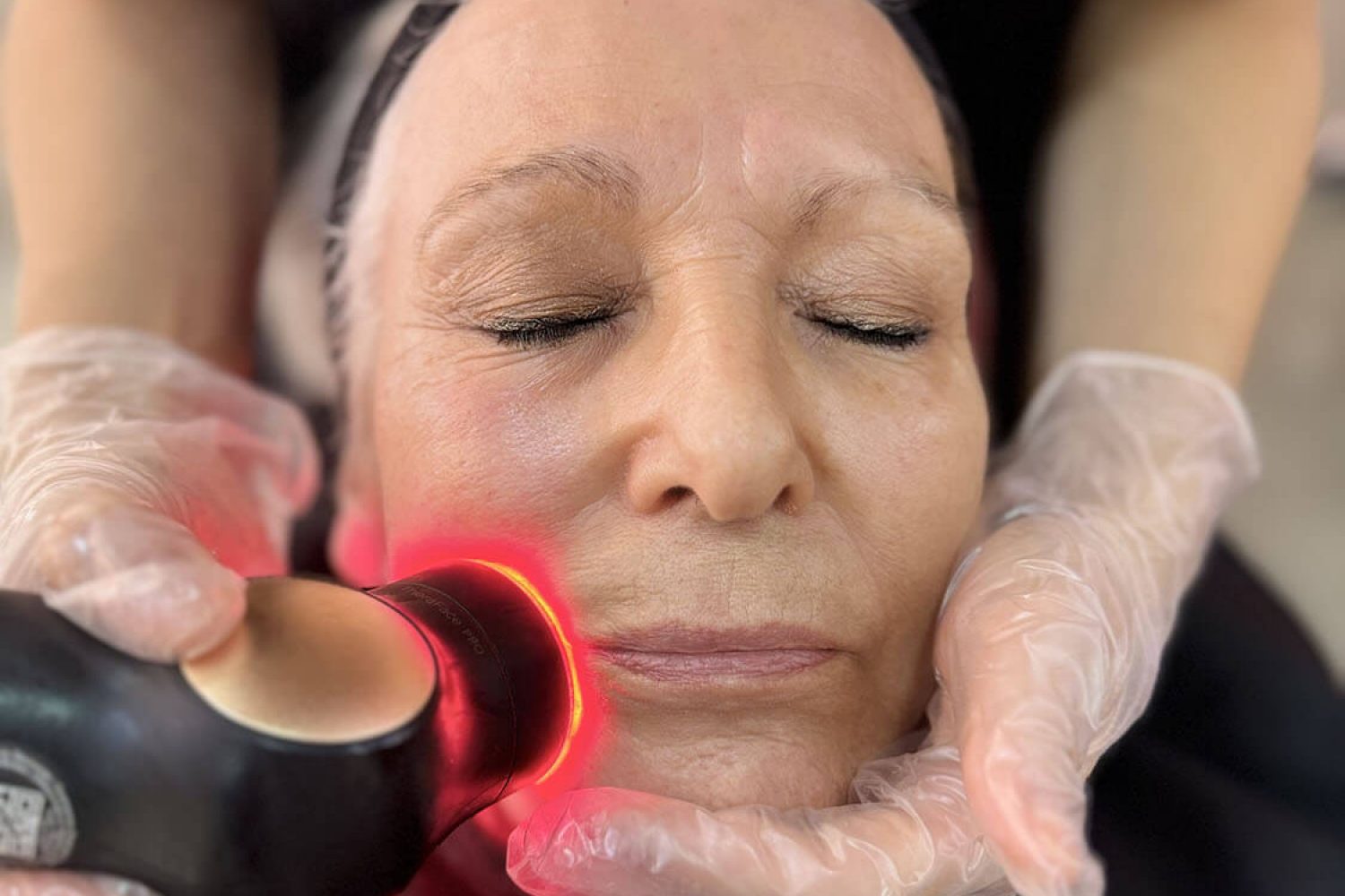 face-fit-entrenamiento-facial